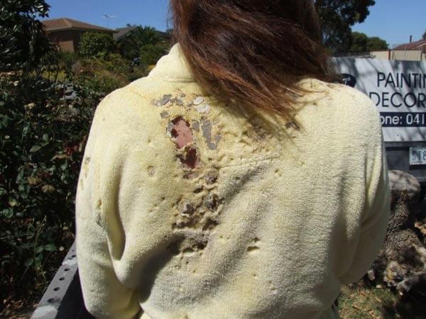 Burnt holes in jersey